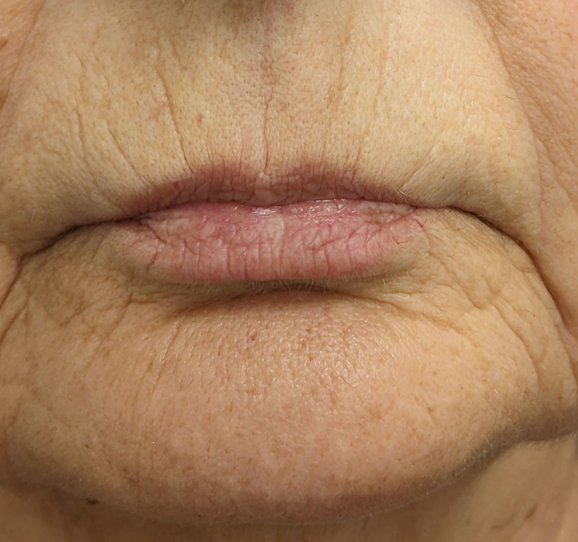 A close up of an older woman 's face with wrinkles on her lips.