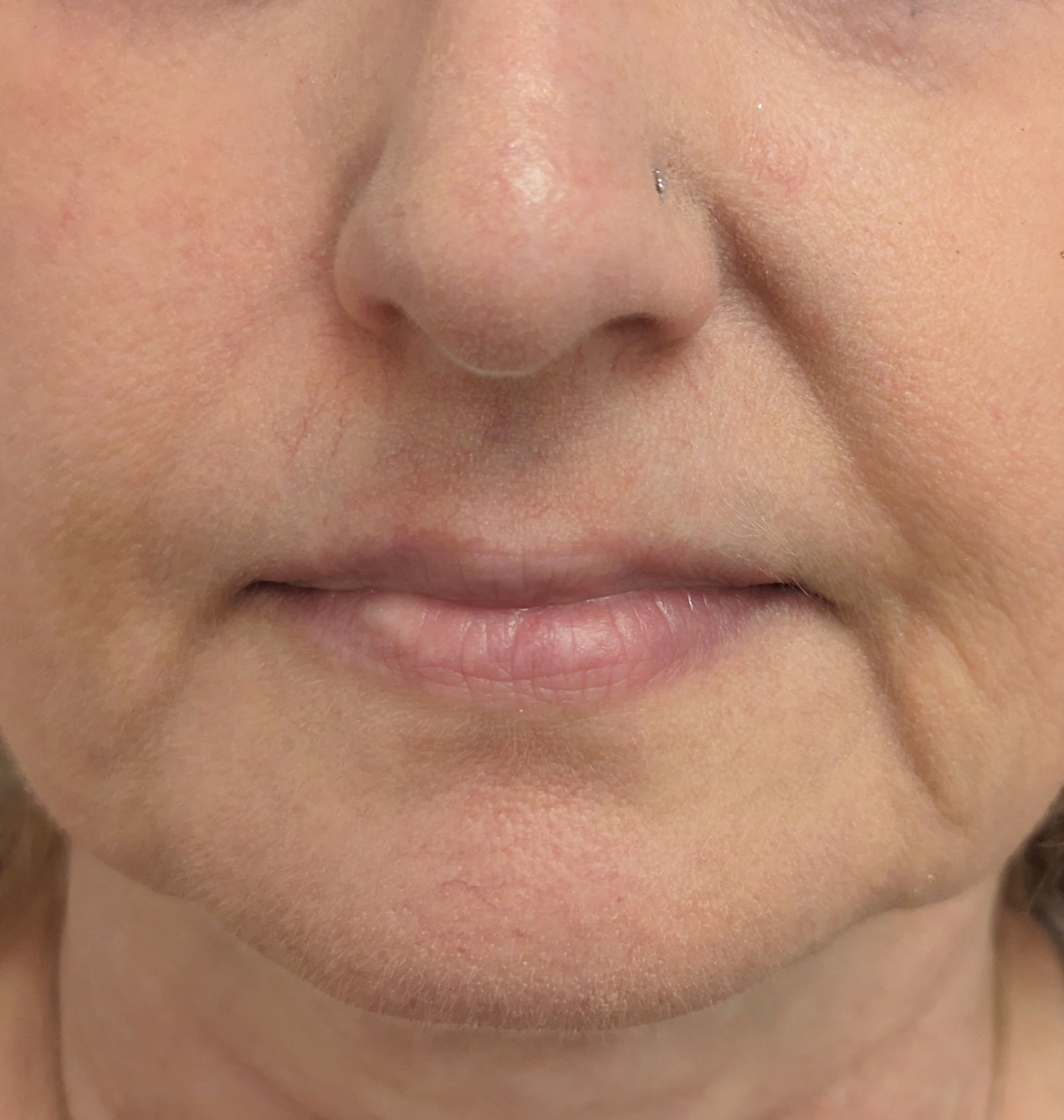 A close up of a woman 's face with wrinkles and a nose.