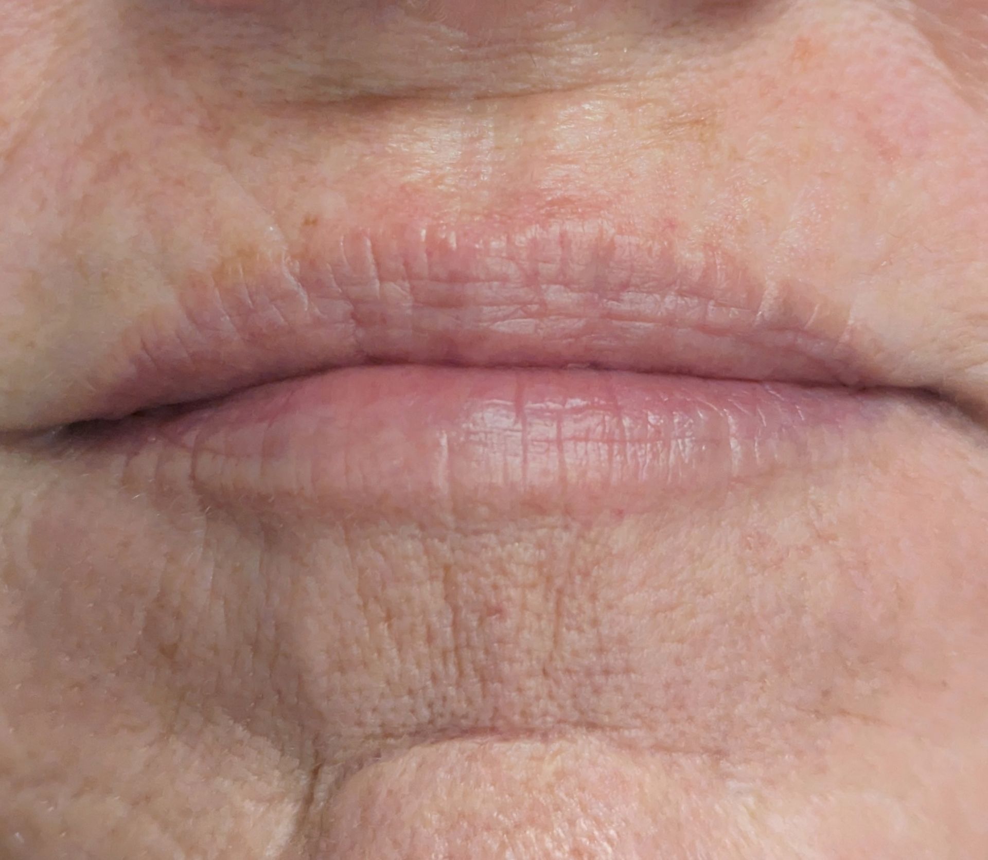 A close up of a woman 's lips with wrinkles.