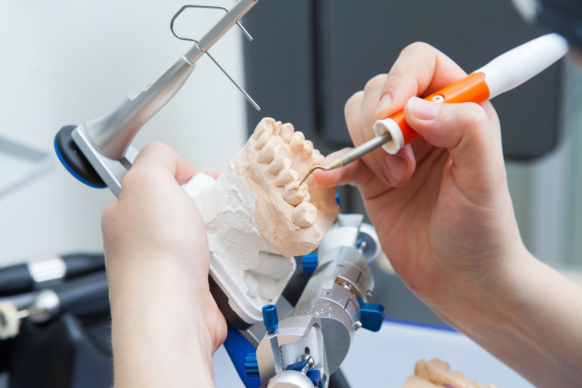 realizzazione protesi dentale fissa