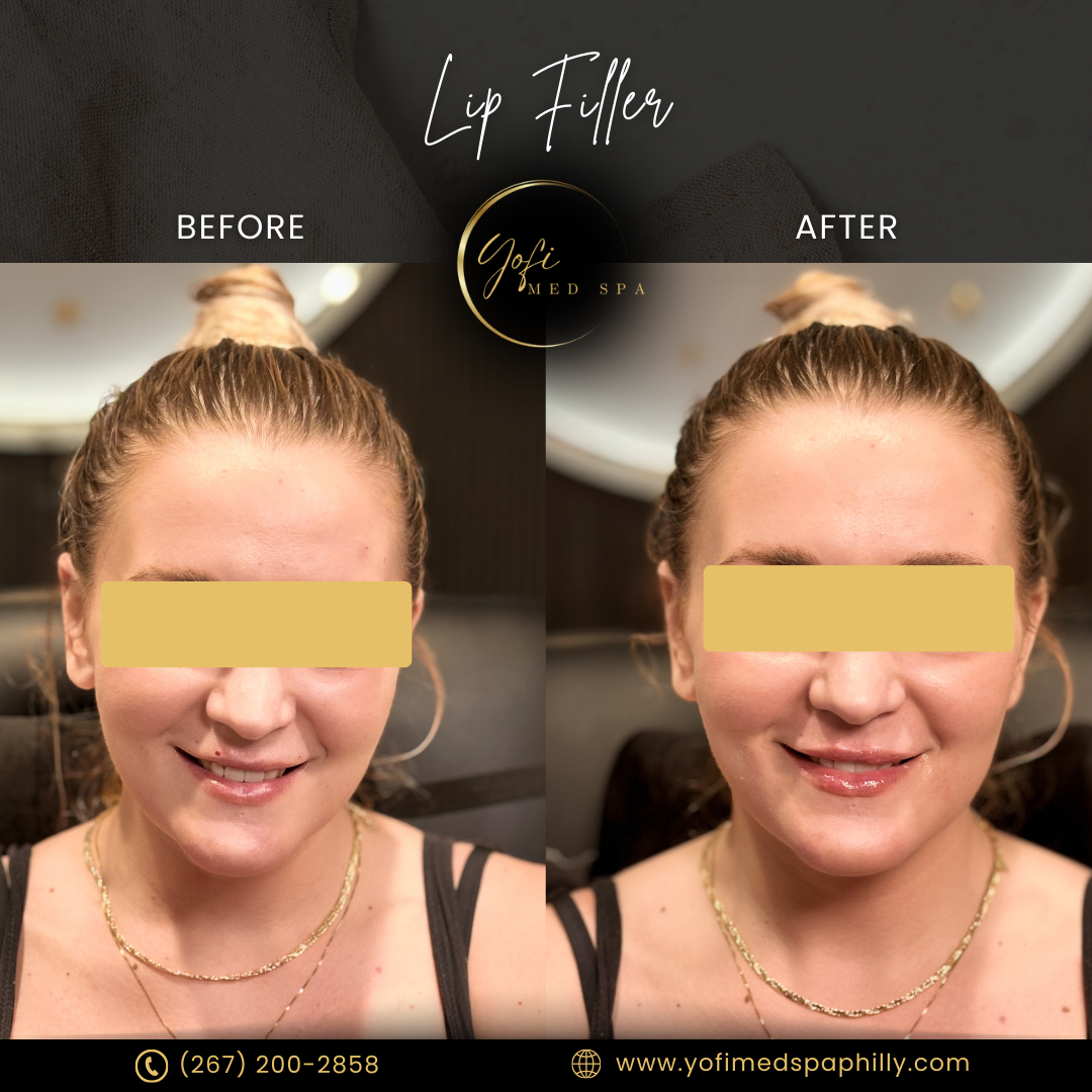 A before and after photo of a woman 's face