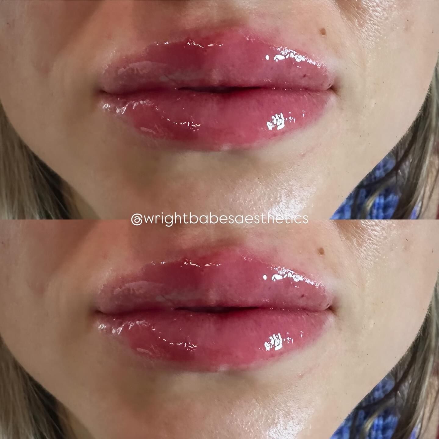 Close-up of a person's lips. The upper and lower lip are glossy and plump. The person's skin is visible.