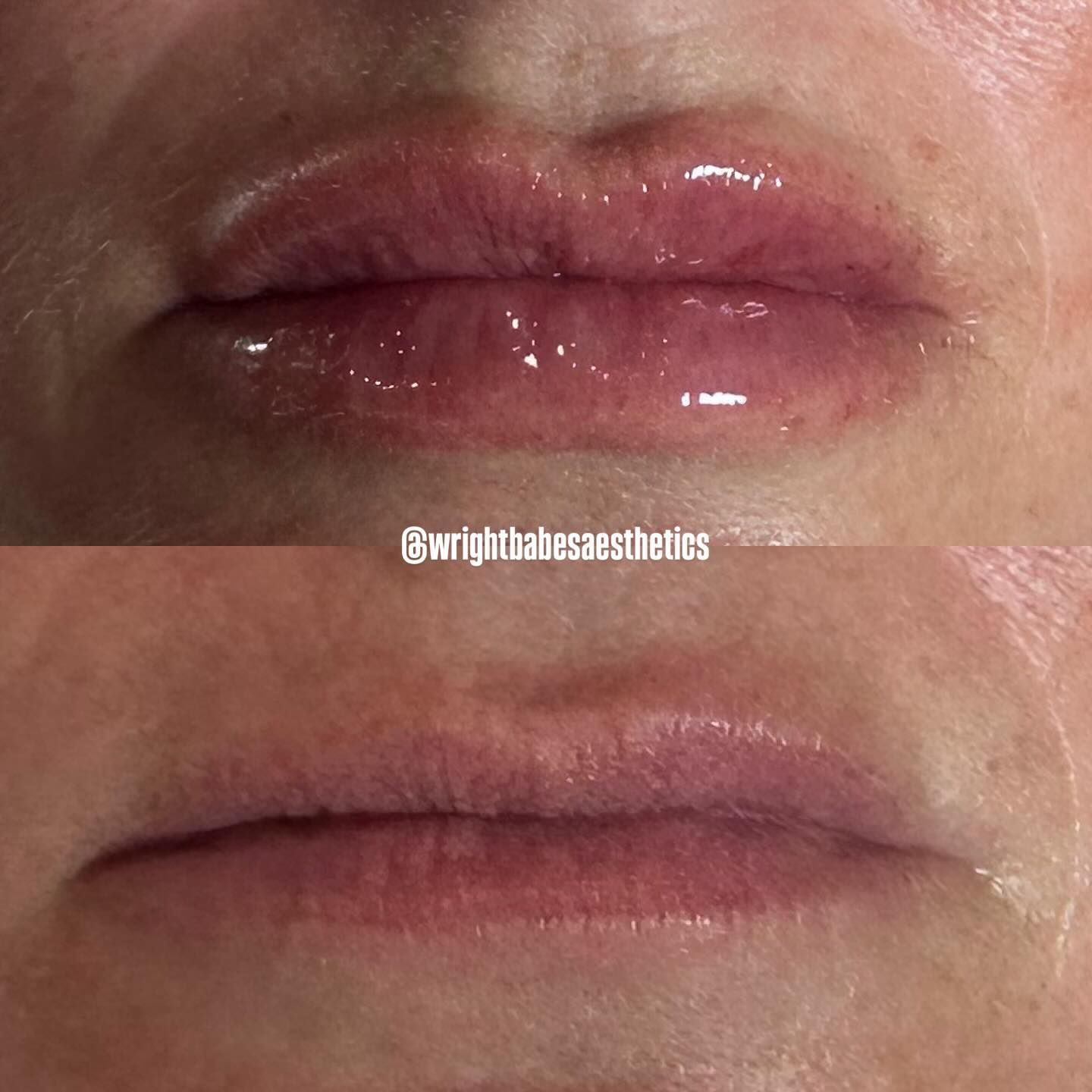 Two views of lips: top view showing glossed, fuller lips; bottom view showing unglossed, thinner lips.
