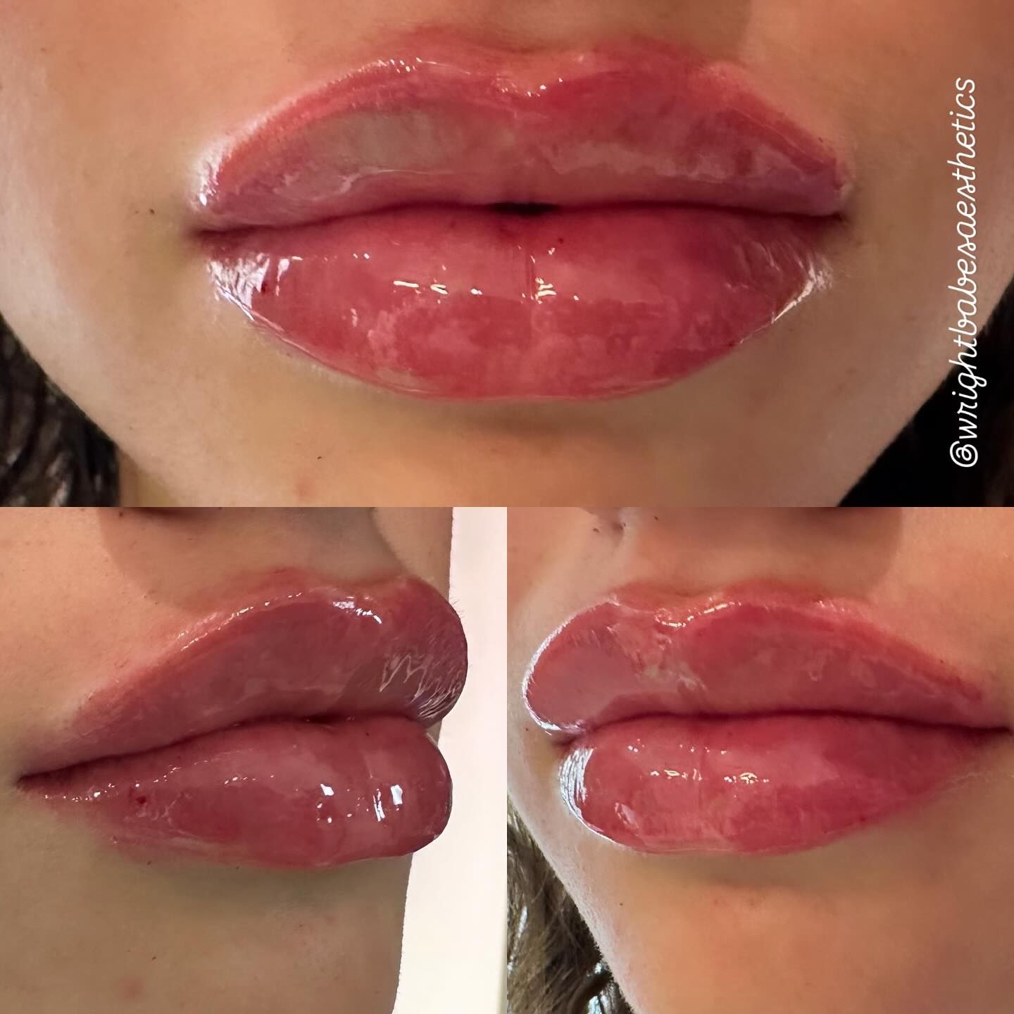 Close-up of glossy pink lips from multiple angles: front, side, and three-quarter view.