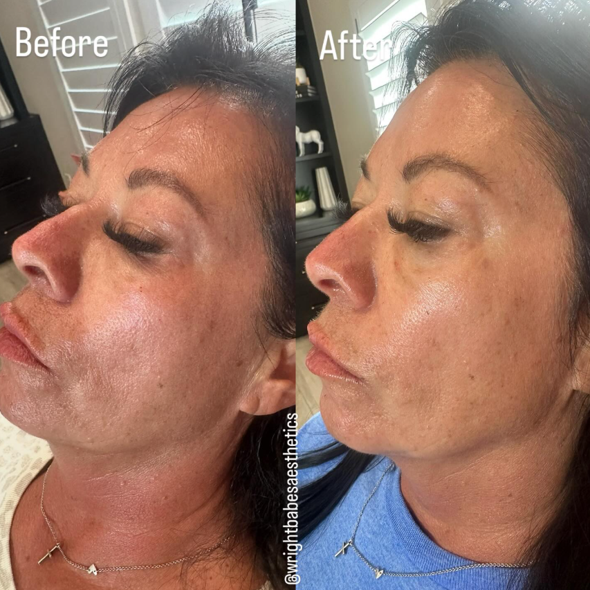 Side-by-side comparison of a person's face. 