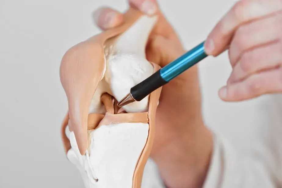 Uma pessoa está segurando uma caneta sobre um modelo de uma articulação do joelho.