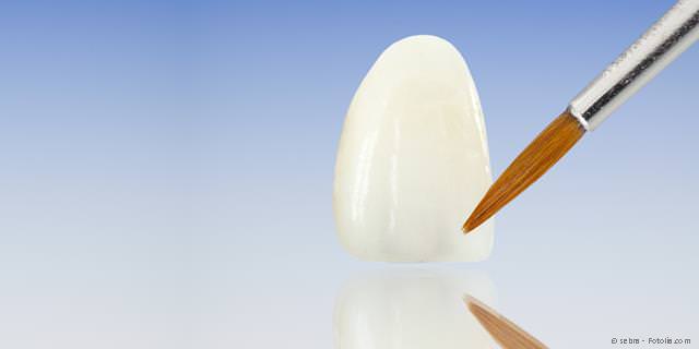Zahnersatz aus dem praxiseigenen Dental-Labor