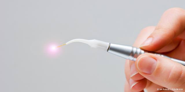 Laser gegen Herpes und Aphthen