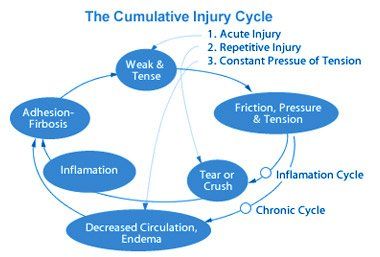 A diagram of the cumulative injury cycle