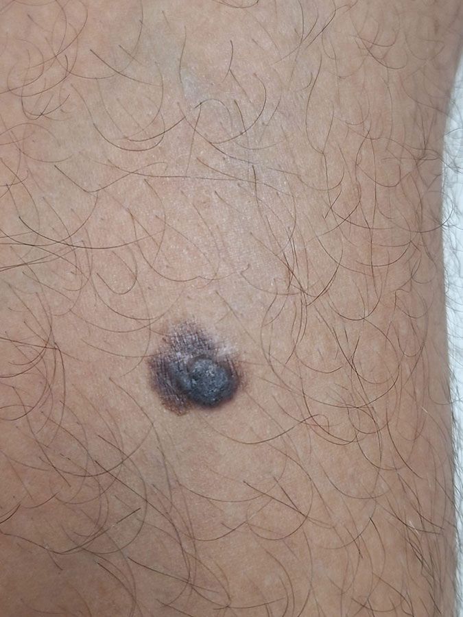 DR. ALEJANDRO GARCIA VARGAS