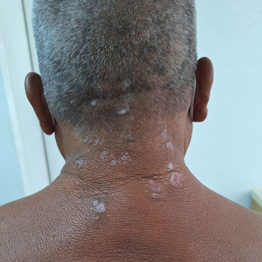 DR. ALEJANDRO GARCIA VARGAS