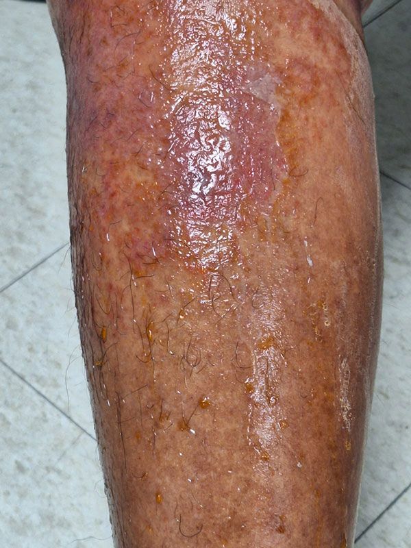 DR. ALEJANDRO GARCIA VARGAS