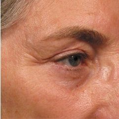 A close up of a man 's face with wrinkles and a blue eye.