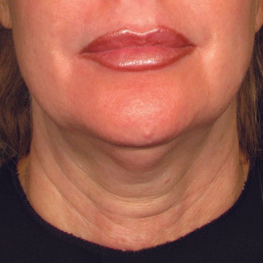 A close up of a woman 's neck and lips