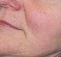 A close up of an older woman 's face with wrinkles.