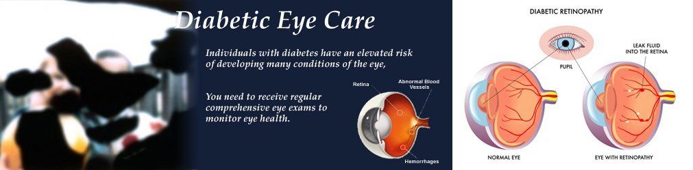 Diabetic Eye Care 1