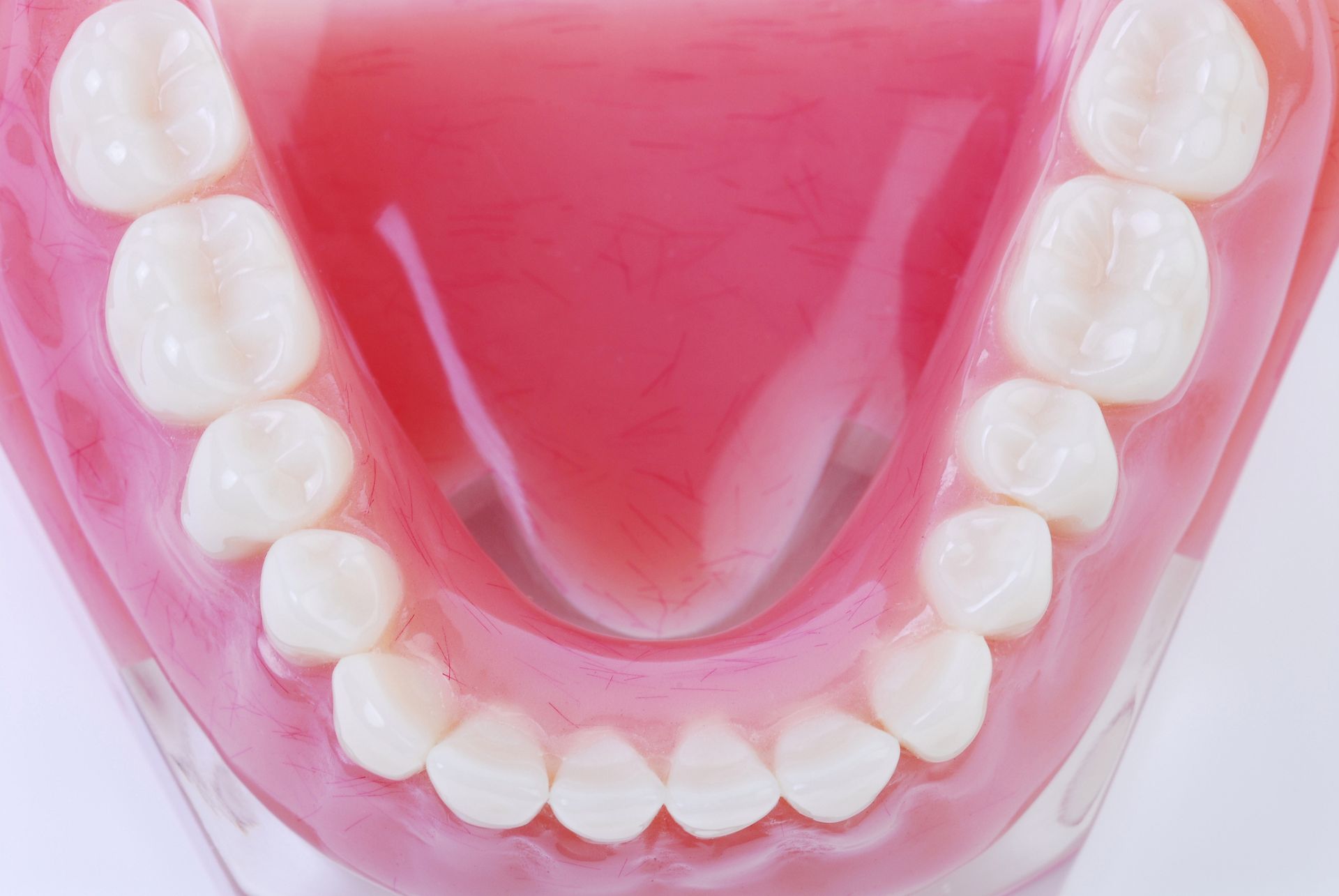 Reline of Full and Partial Dentures — Miranda, NSW — Peter Kammerloher Denture Clinic
