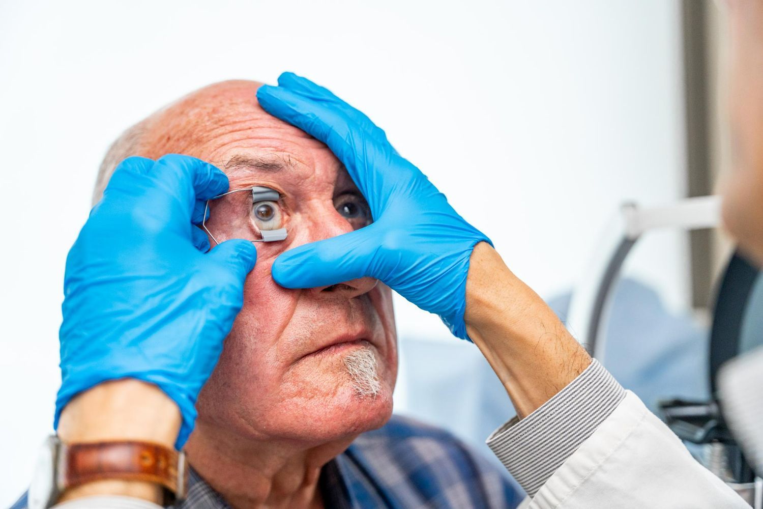 Blue-gloved hands pull open a man's eyelid during an eye exam in a clinic