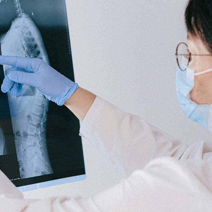 Doctor in mask and blue gloves pointing at an X-ray of a spine