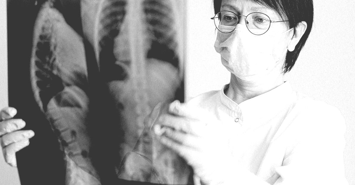 A woman in a mask is holding an x-ray of a person 's chest.