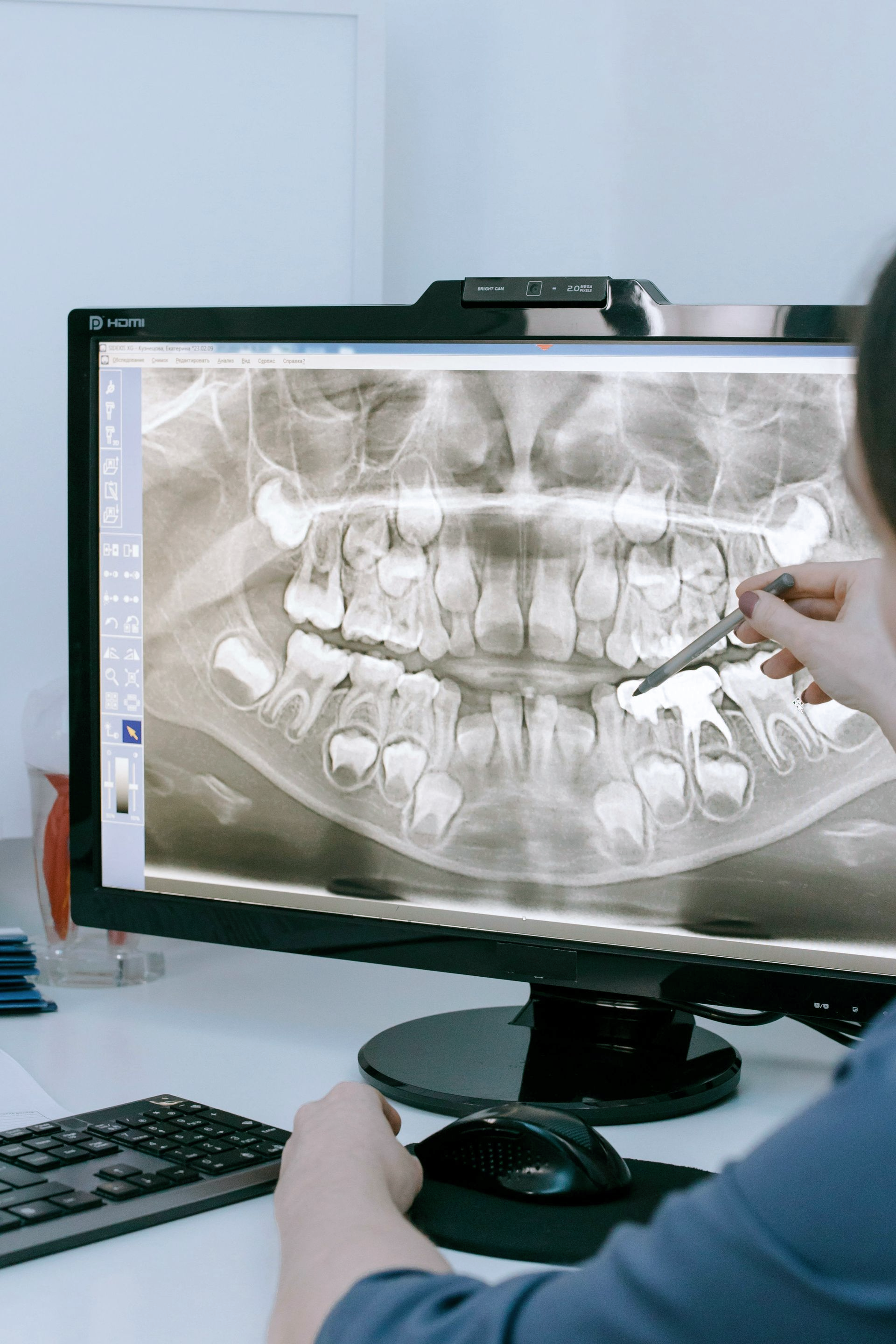 A dental x-ray image