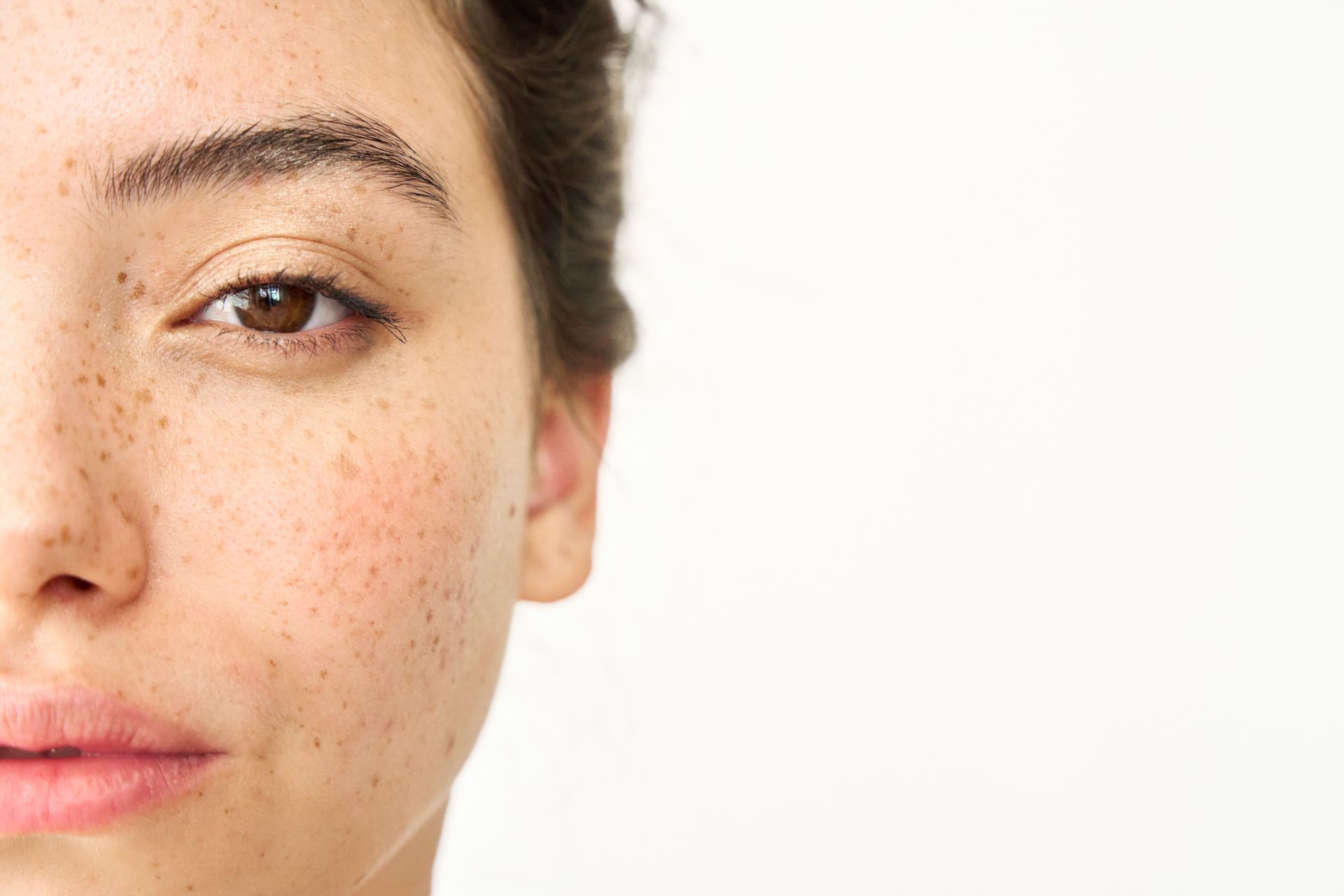 A close up of a woman 's face with freckles on it.