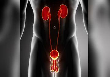 Cáncer de próstata