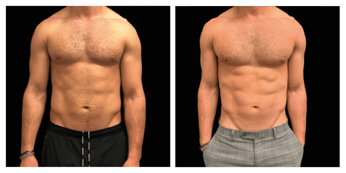 A before and after picture of a man 's torso.
