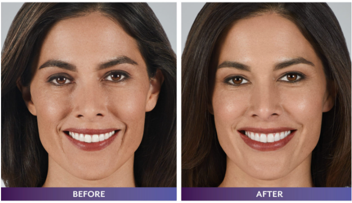 A before and after photo of a woman 's face.