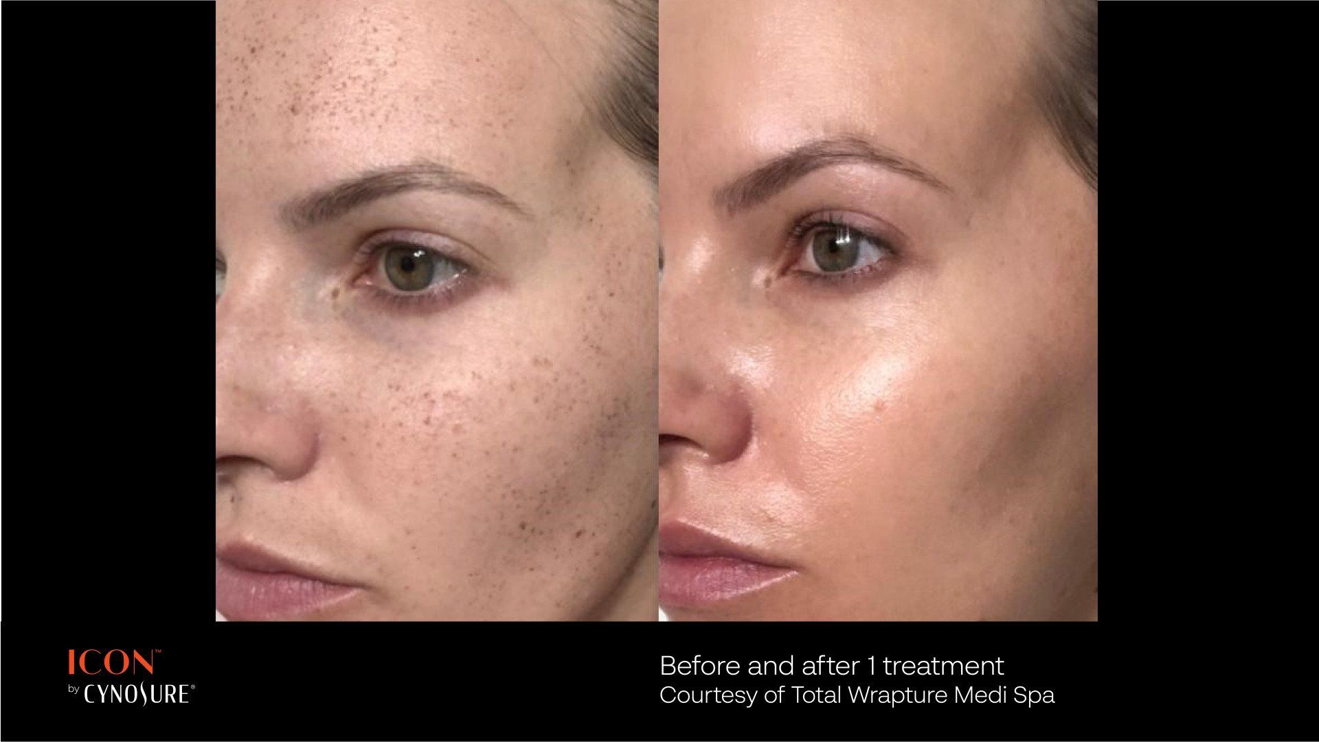 A before and after photo of a woman 's face