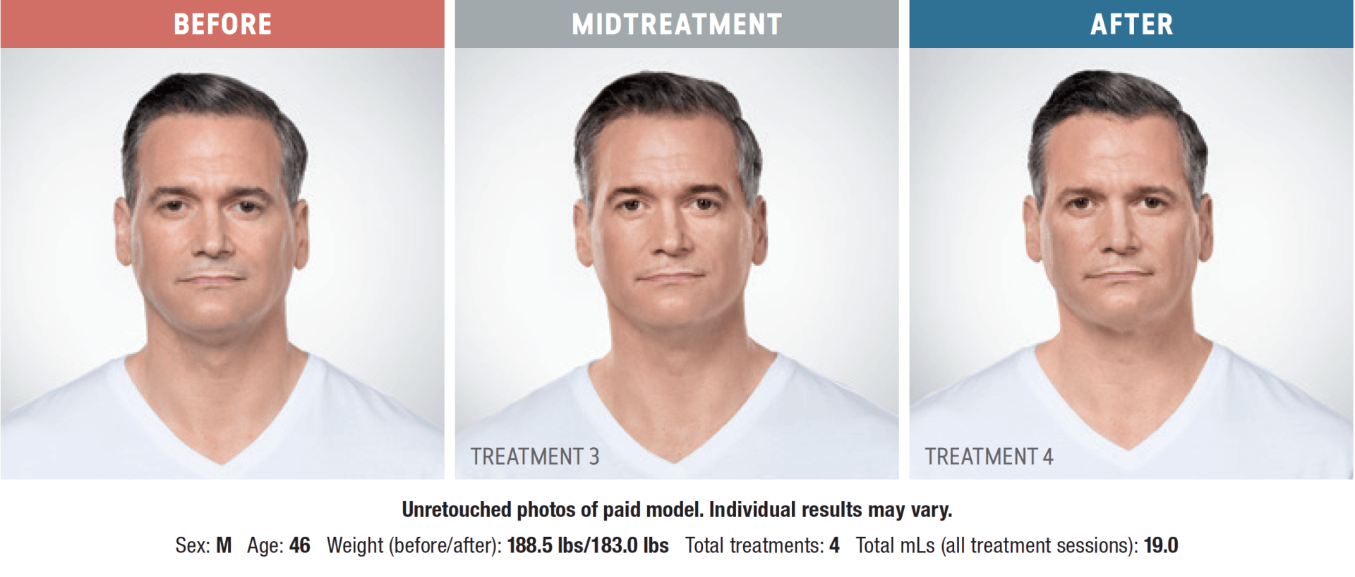 A before and after photo of a man 's face.