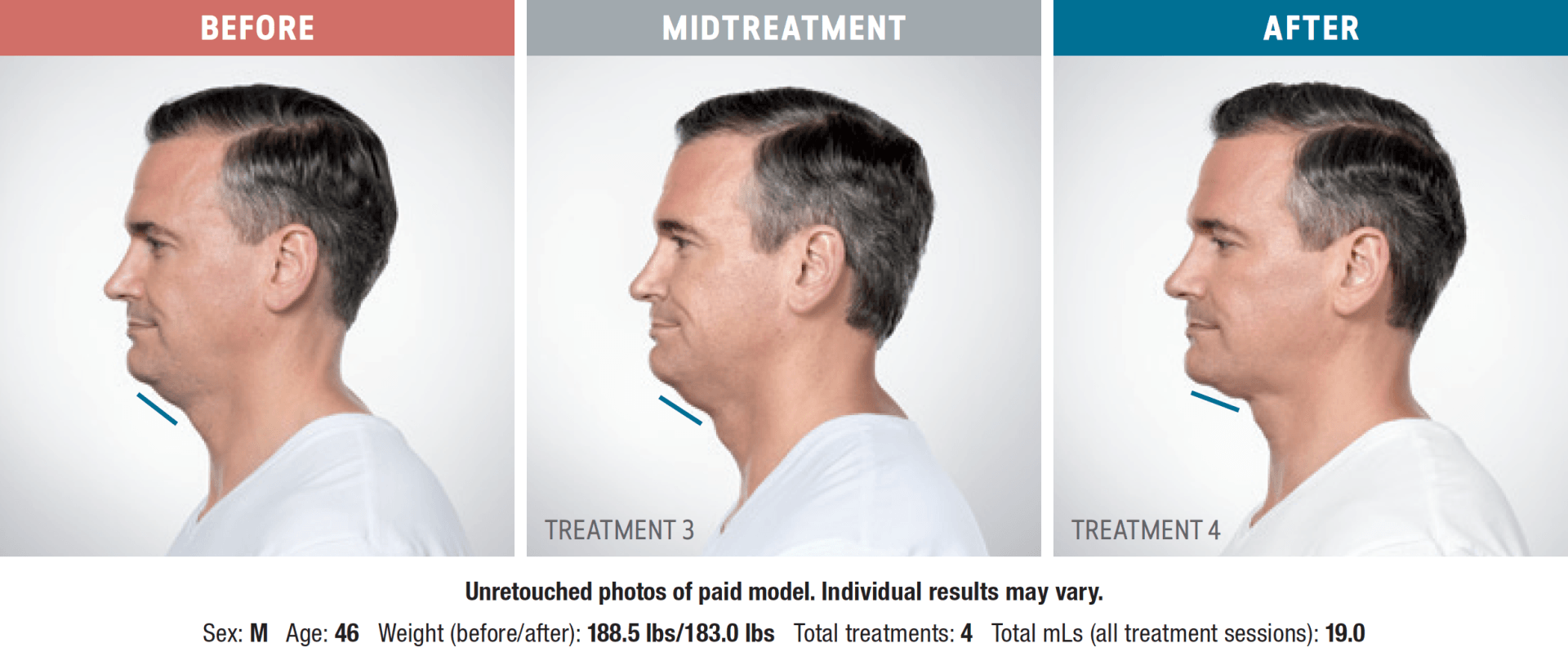 A before and after picture of a man 's neck