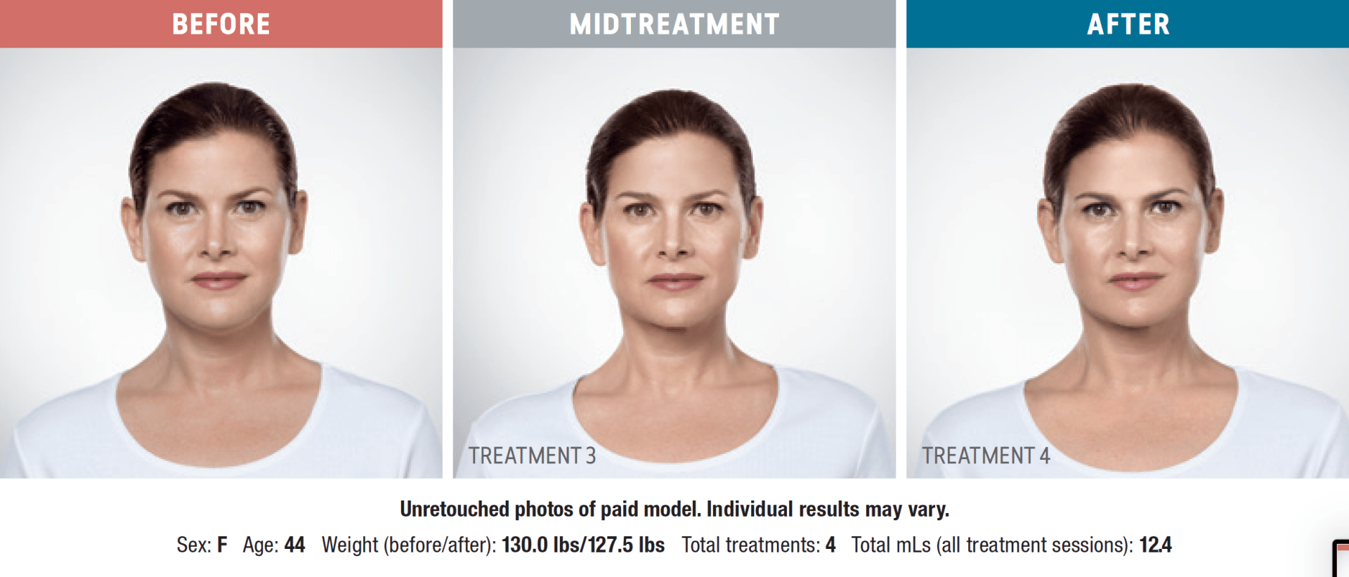 A woman 's face is shown before and after a treatment.