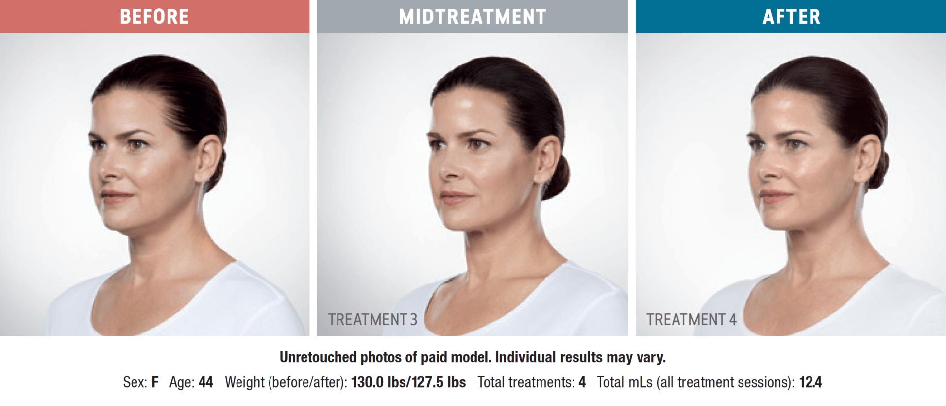 A woman 's face is shown before and after a treatment.