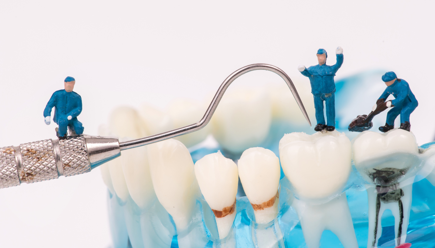 A group of miniature people are working on a model of teeth.
