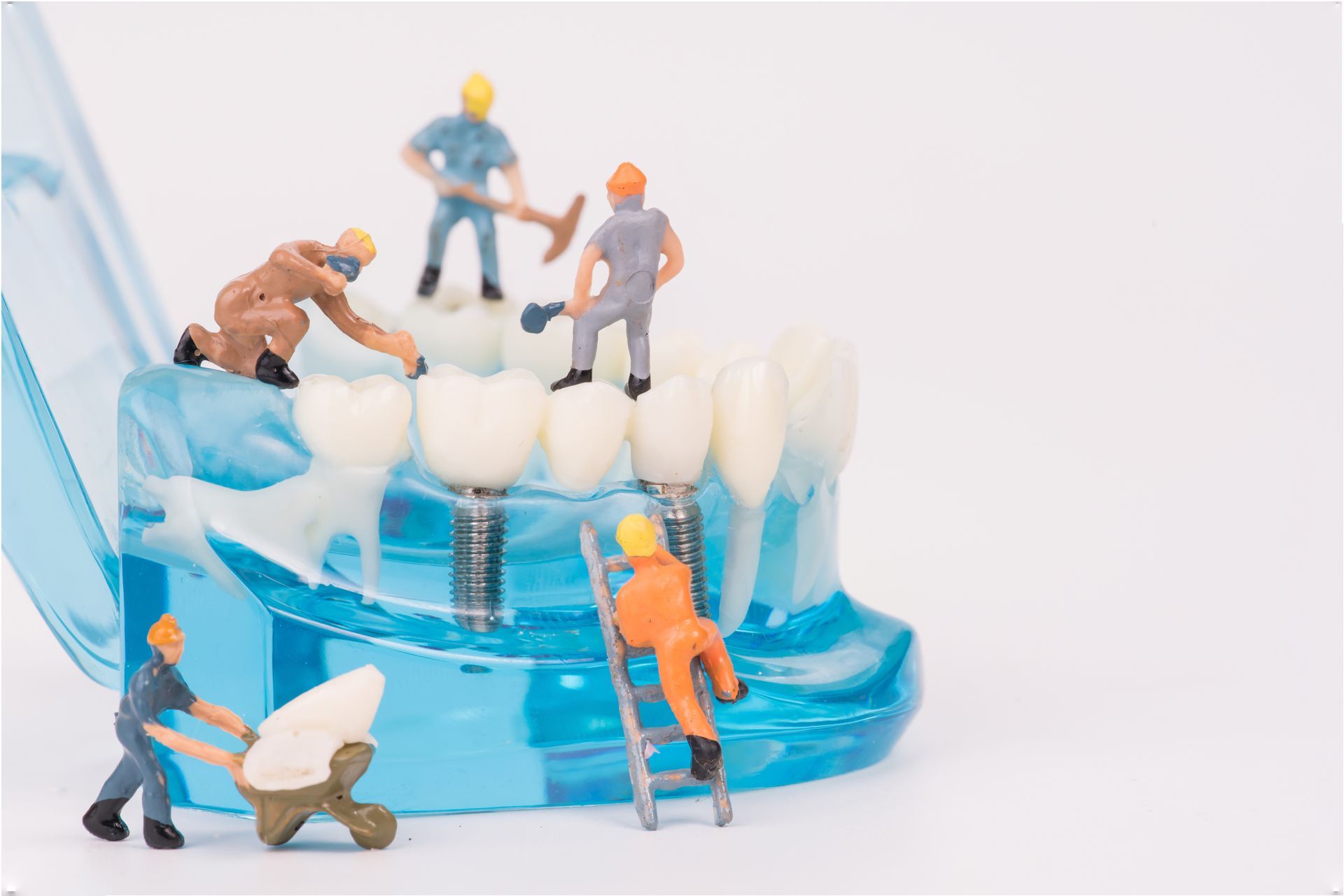 A group of miniature people are working on a model of teeth.