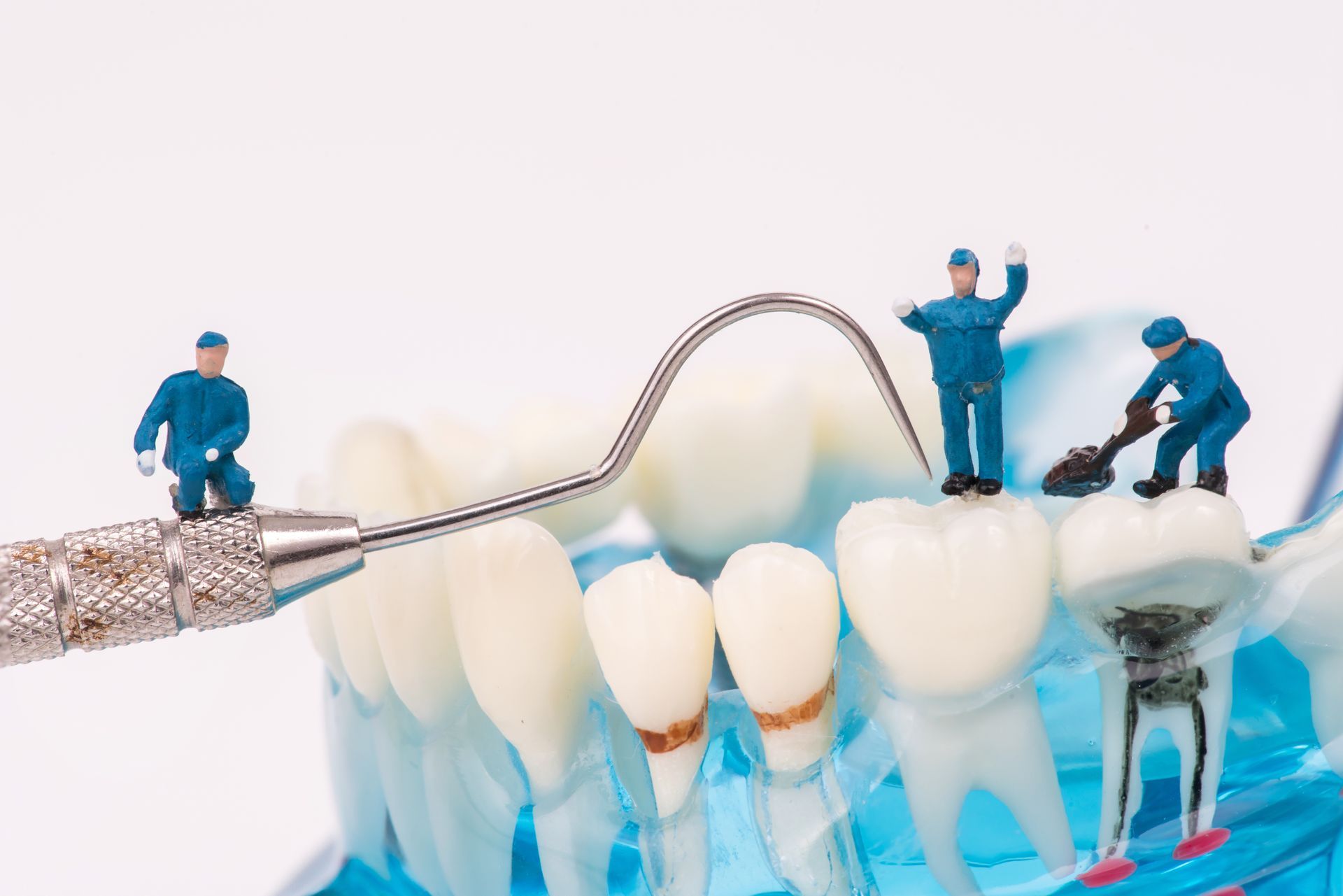 A group of miniature people are working on a model of teeth.