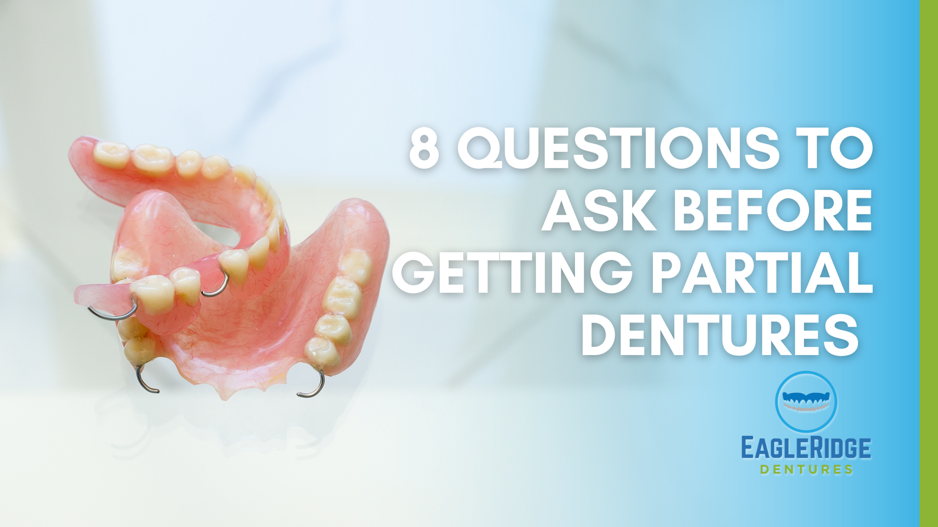 Partial Dentures and title 8 Questions to Ask Before Getting Partial Dentures