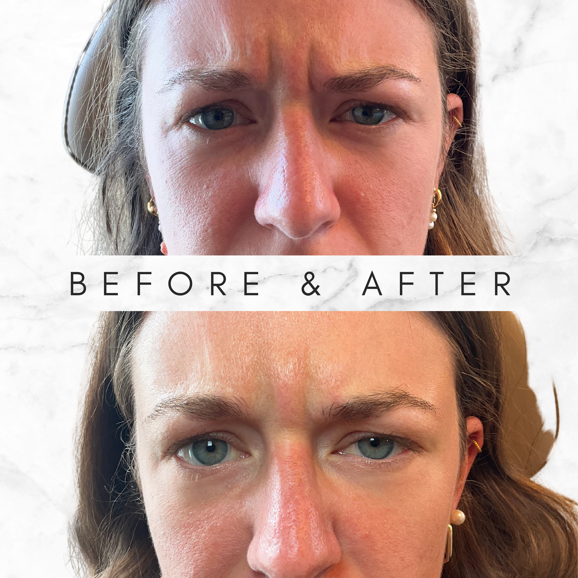 A before and after photo of a woman 's face