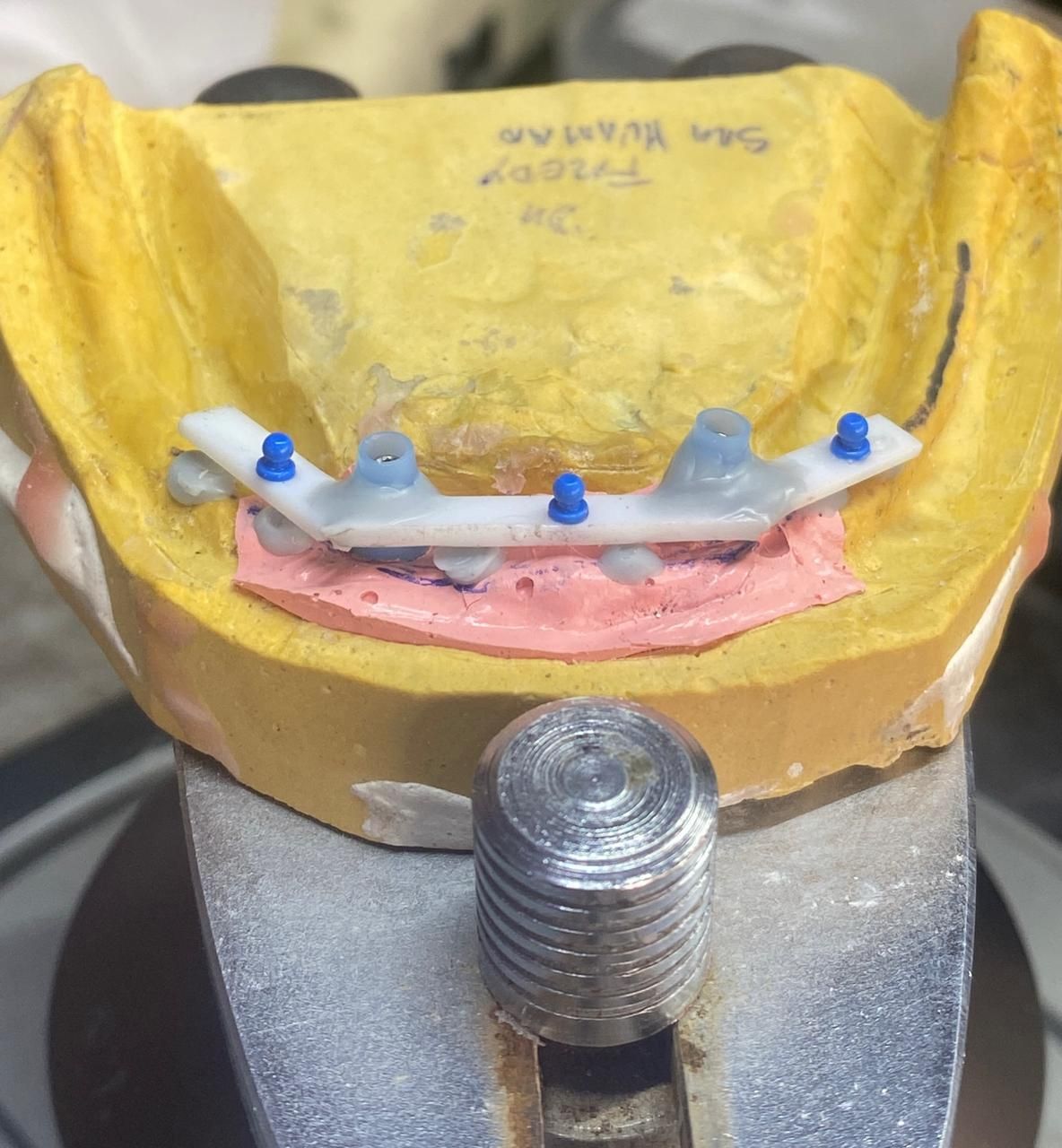 Un plato blanco con una imagen de dientes.