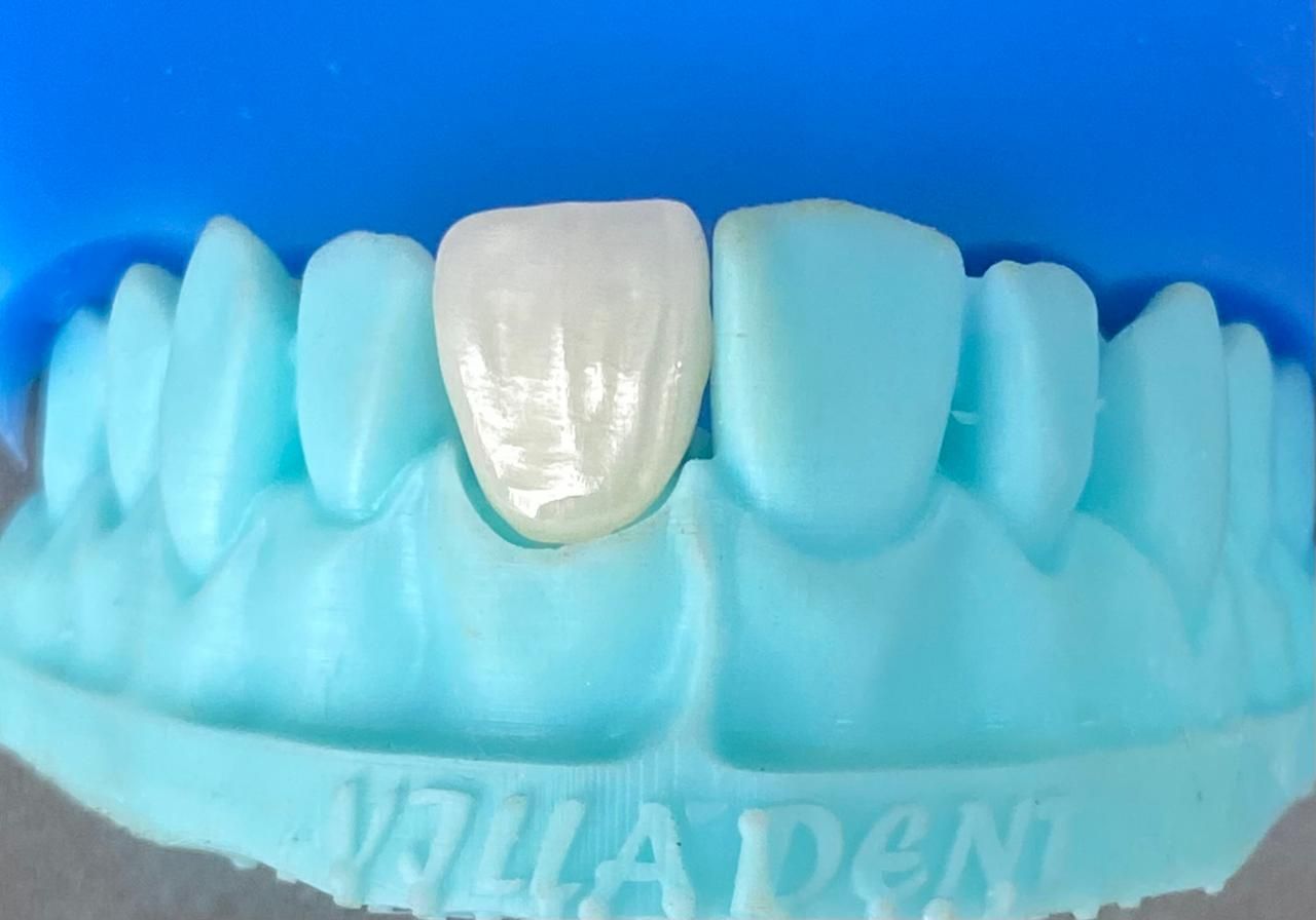 Un primer plano de una dentadura postiza con agujeros sobre una mesa.