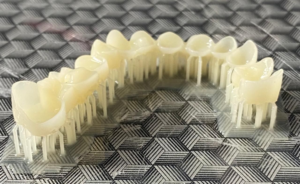 Un dentista sostiene un modelo de un implante dental en sus manos.