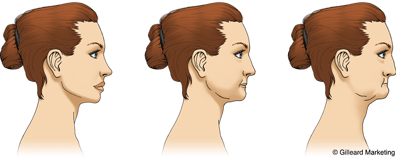 Three drawings of a woman 's face showing different stages of aging