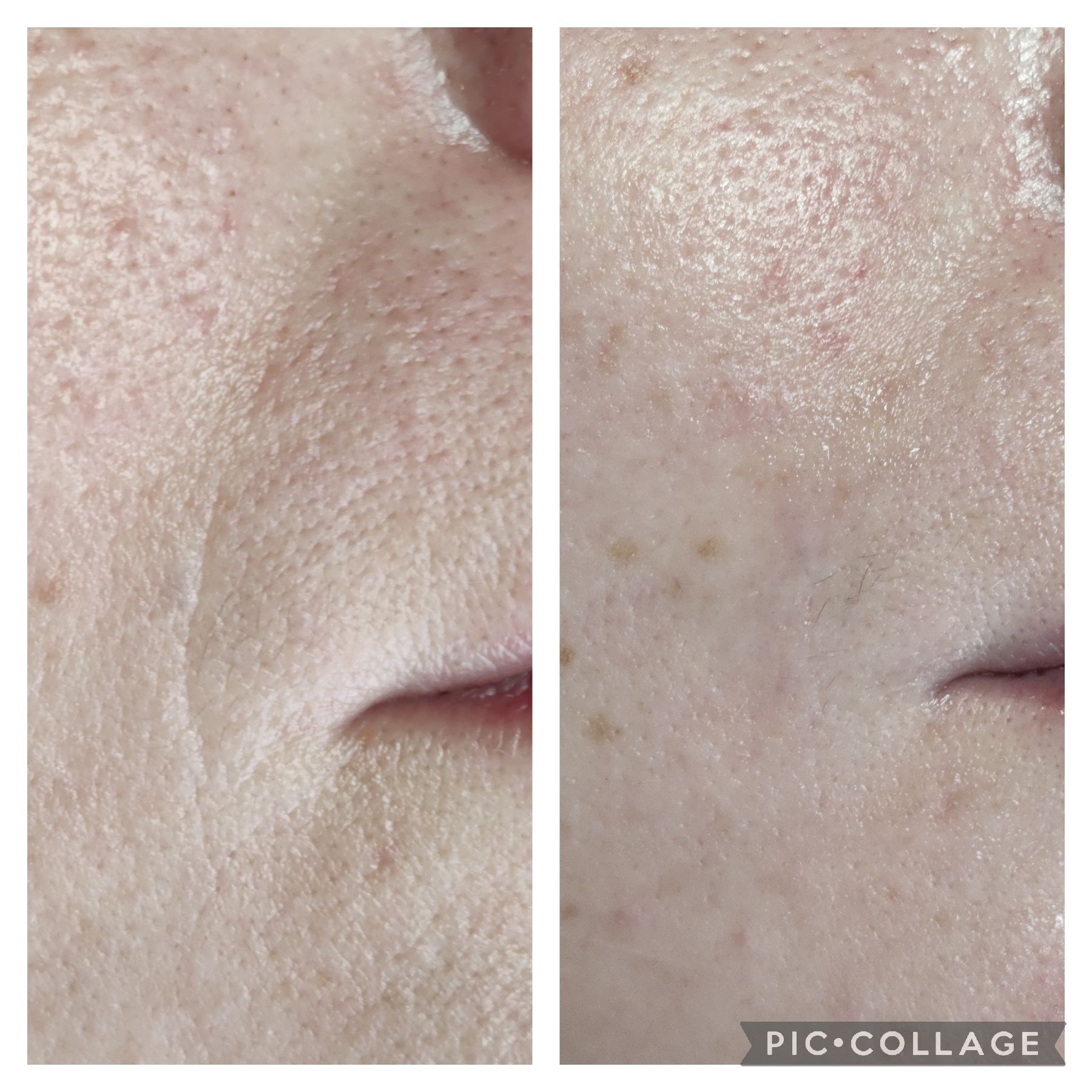Comparison of skin texture: left side has wrinkles and pores, right side is smoother with fewer visible imperfections.