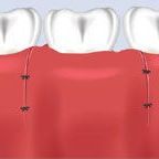 Periodontist closes area