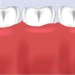 Bone grafting material will integrate with bone