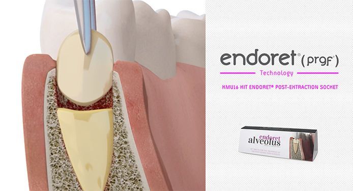 PRGF Endorse Regeneration