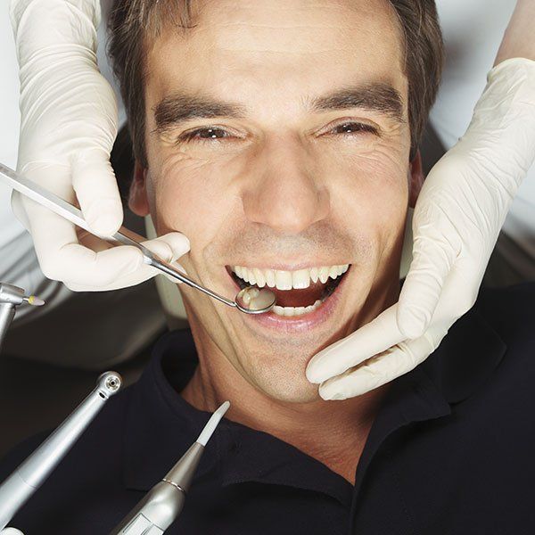 Igiene dentale e Sbiancamento