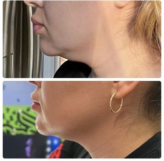 A before and after photo of a woman 's neck with hoop earrings