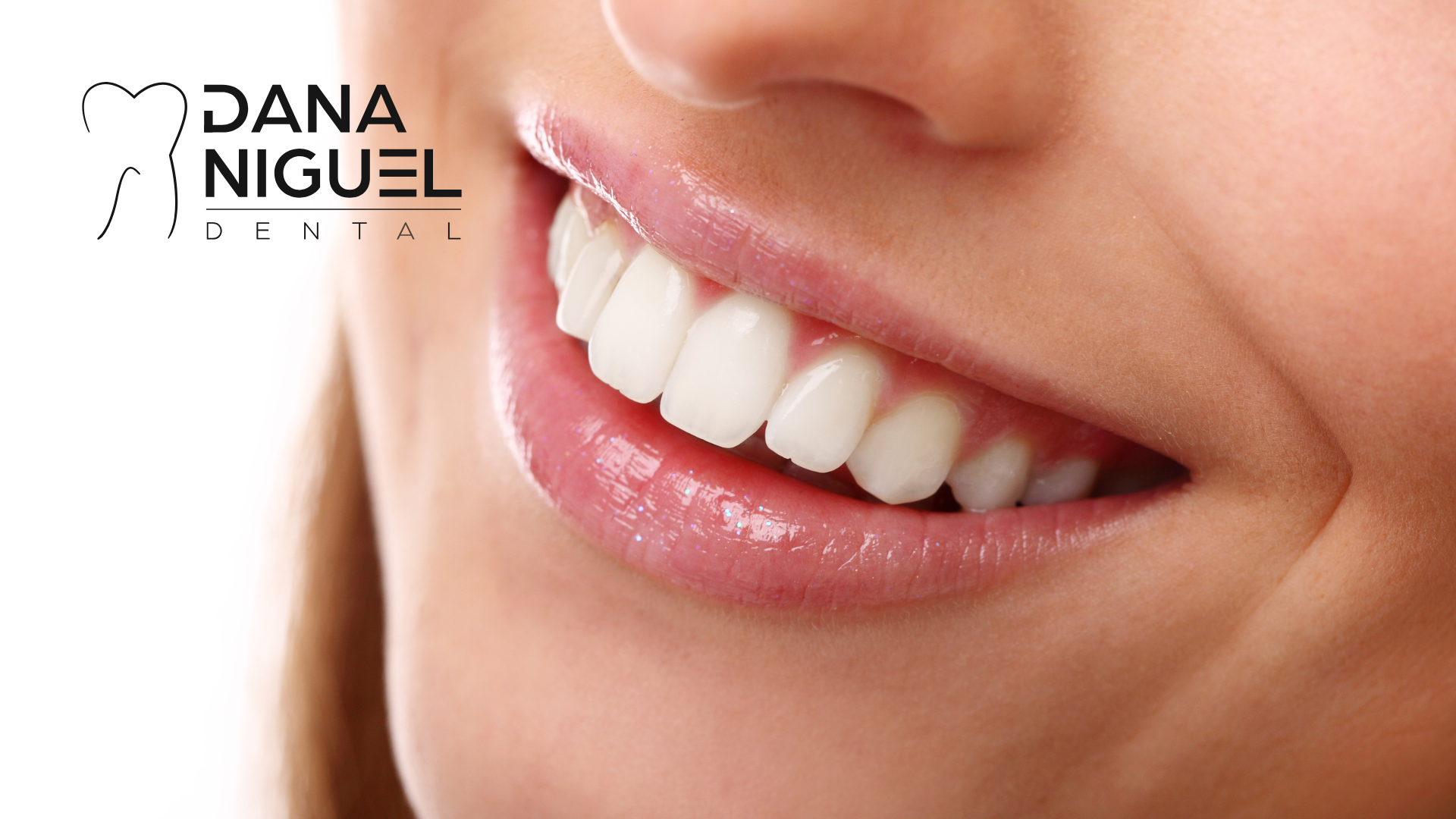 A close up of a woman 's smile with dana niguel dental in the background.